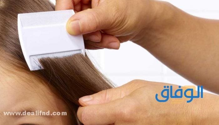 علاج القمل للأطفال علاج القمل للأطفال