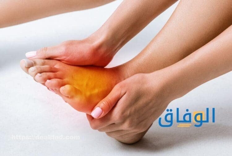 علاج سخونة القدمين بالأعشاب - بسهولة وسرعة علاج حرارة القدمين عند النوم