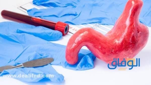 تجربتي مع عملية تحويل مسار