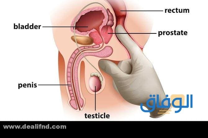 أعراض سرطان البروستاتا أعراض سرطان البروستاتا
