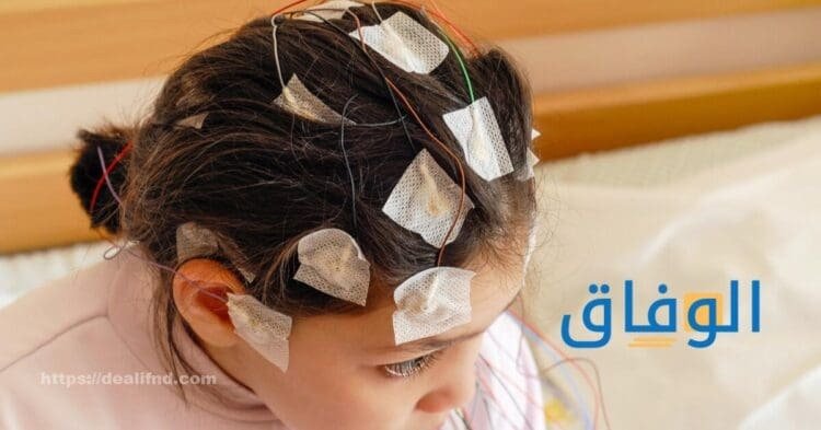 علاج الصرع نهائياً 10 أسباب للإصابة بالصرع علاج الصرع نهائياً