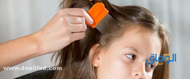 علاج القمل للأطفال علاج القمل للأطفال