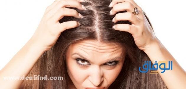 علاج القمل والصيبان مجرب