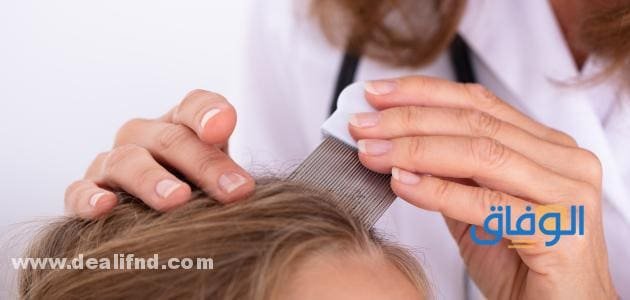 علاج القمل للأطفال