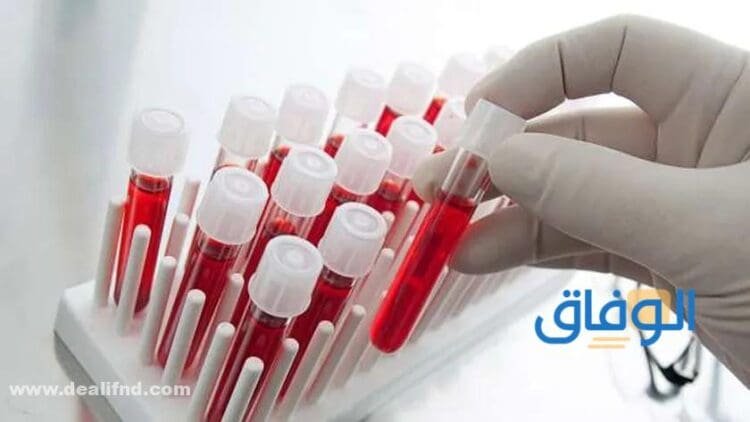 سعر تحليل cbc في مصر 2024