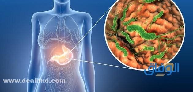 أعراض جرثومة المعدة النفسية