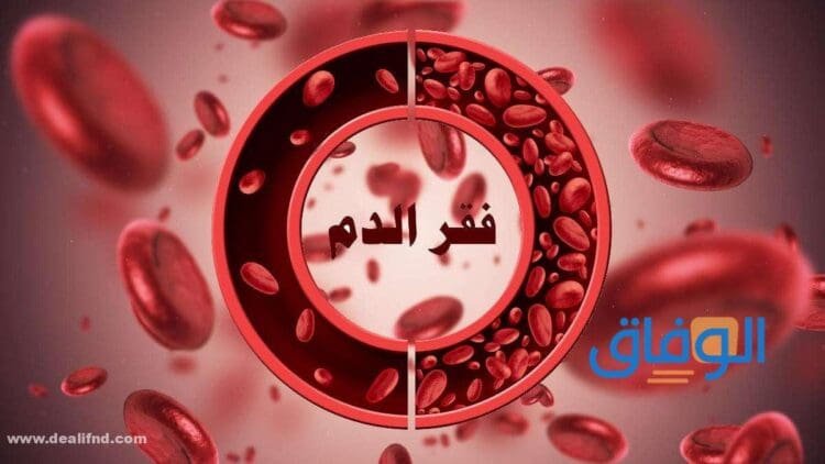 +09 اسباب فقر الدم +07 وطرق الوقاية والعلاج
