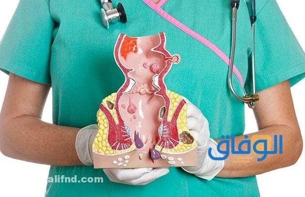 +07 أهم أعراض البواسير عند النساء | وما هي طرق العلاج ما هو علاج البواسير الخارجية عند النساء