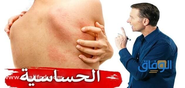 مشروبات لعلاج الحساسية الجلدية