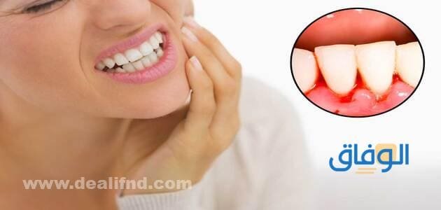 +04 (اقوي علاج لتقوية اللثة) والحفاظ عليها | صحية وسليمة - موقع الوفاق تقوية اللثة بتفريش الأسنان