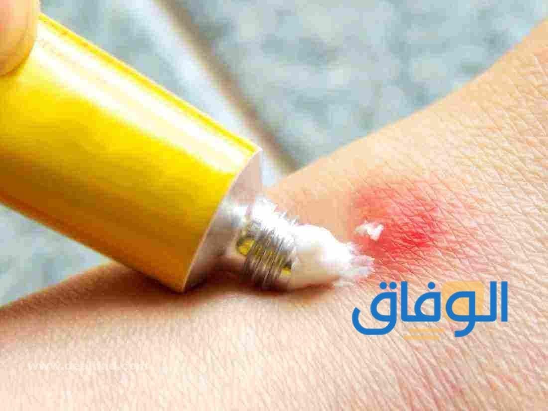 +06 كريم قرصات الناموس | وأسعاره في السعودية 1445