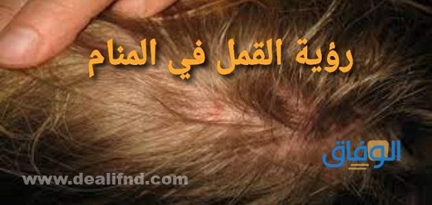 رؤية القمل في المنام