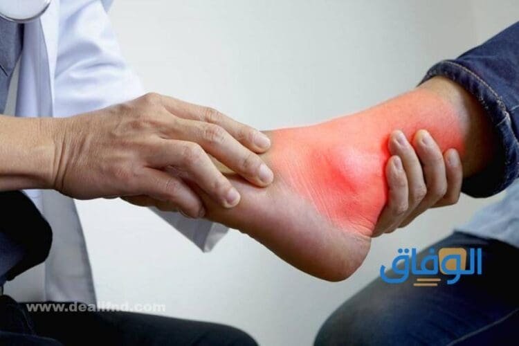 طرق علاج الأملاح في الجسم | مشروبات للتخلص من الأملاح الزائدة كيف أعرف نسبة الأملاح في الجسم