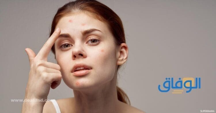 أسباب الدمامل المتكررة – 10 أسباب قد تقلب حياتك رأسًا على عقب