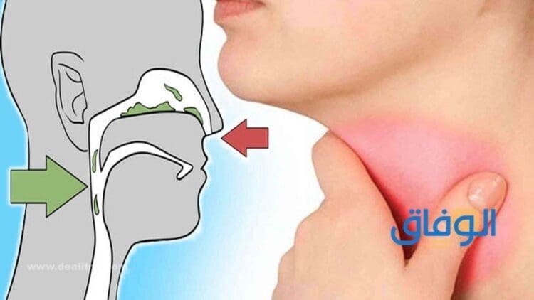 أسباب البلغم