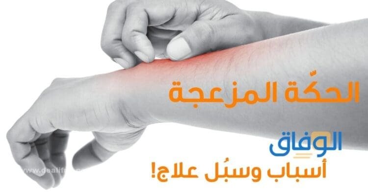 علاج الحكة الشديدة – +5 طرق ستقضي عليها فورًا