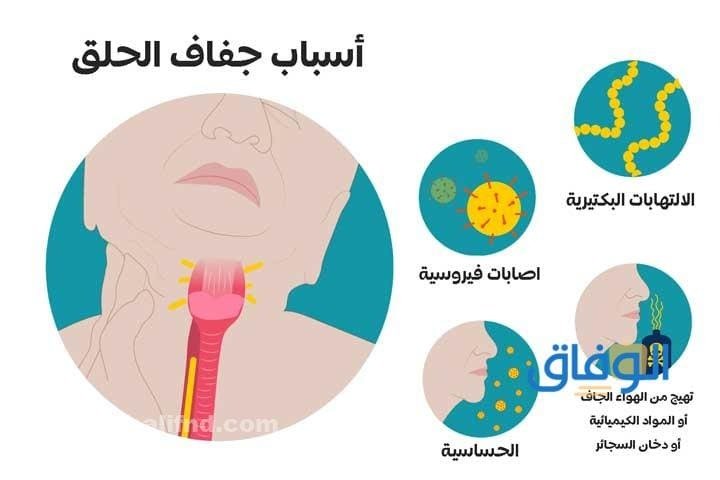 أسباب جفاف الحلق – +15 سبب مؤدي للحلق الجاف