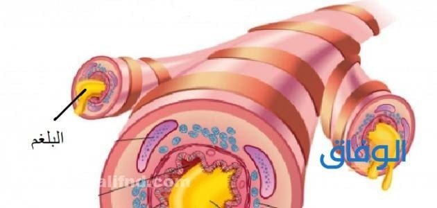 التخلص من البلغم بسرعة طبيعيًا | أدوية للقضاء على البلغم