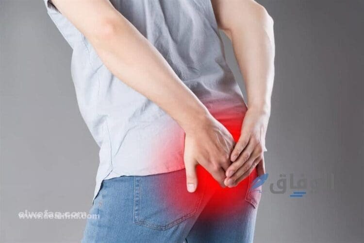 أعراض الناسور العصعصي