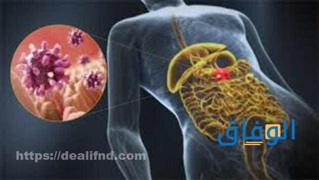 الأعراض الشائعه للنزله المعوية و اسهل الطرق للوقاية منها