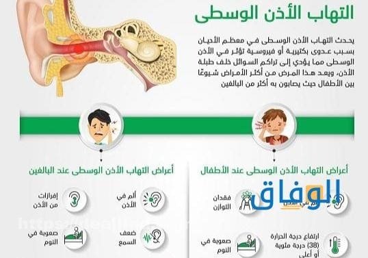 اعراض الاذن الوسطى | أسباب التهاب الأذن الوسطى وعلاجها اعراض الاذن الوسطى