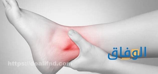 اعراض التهاب بالاعصاب 