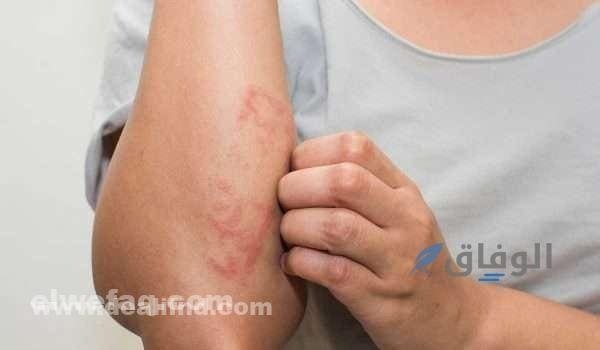 الحزام الناري بالصور