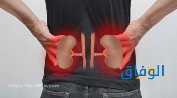 اعراض التهاب الكلى | 5 طرق منزليه لعلاج للالتهاب الكلوي عوامل خطر عدوى الكلى