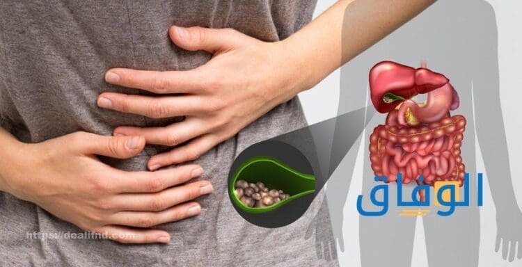 أعراض حصى المرارة