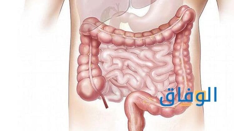 أعراض التهاب الأمعاء| +4 طرق للوقاية لا يعرفهم الكثير!