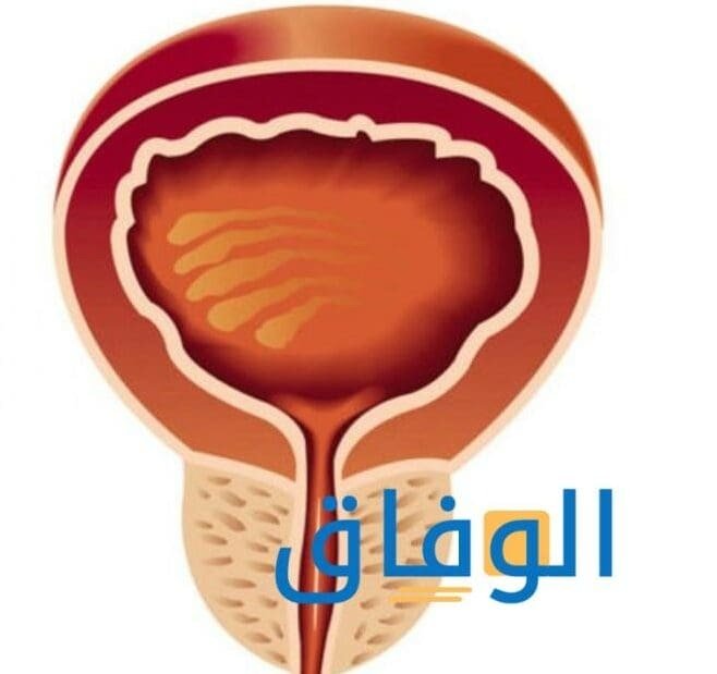 أعراض التهاب البروستاتا