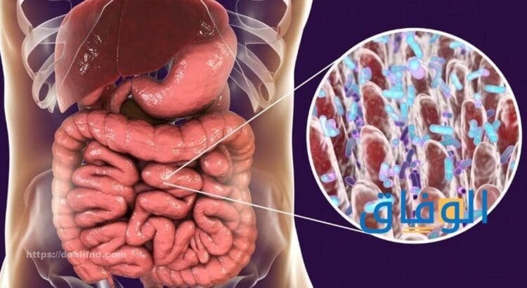 أعراض القولون النفسية | +10 علاج القولون العصبي بالعقاقير