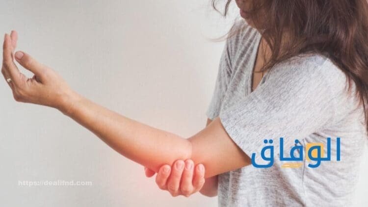  أسباب تنميل اليد اليسرى | أهم طرق علاجها