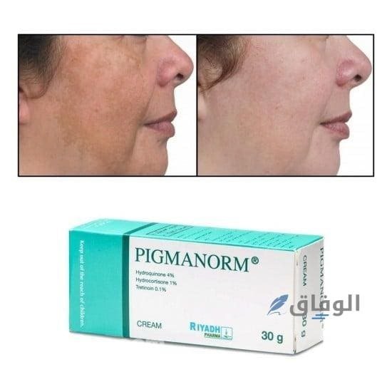 كريمات تفتيح البكيني