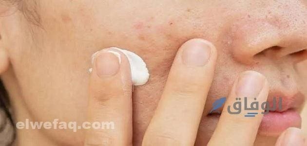 كريمات آثار الحبوب