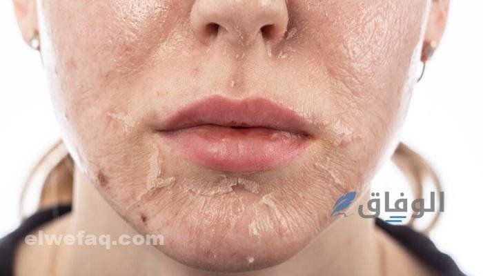 كريمات التقشير للوجه أفض 5 كريمات لتقشير الوجه