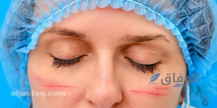 كريمات تجميل الوجه | سحر يزيل كل آثار الجروح