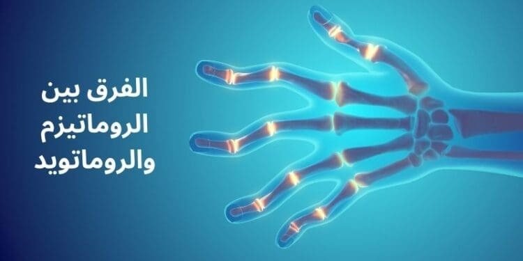 الفرق بين الروماتيزم والروماتويد | الأعراض، الأسباب، ونسبة الشفاء